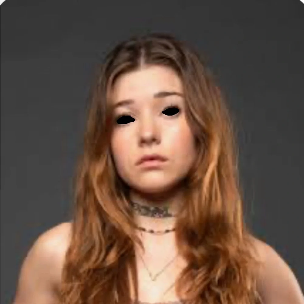 Katie Douglas black eyes with blood